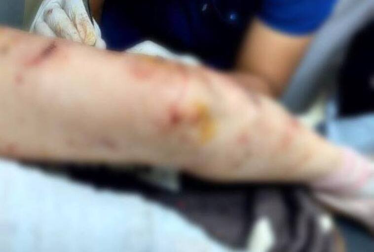 Mujer sufrió múltiples lesiones tras ataque de seis canes en Oruro; el propietario fue aprehendido 705682084 1294550322784286 8827805859598815747 n 1 1