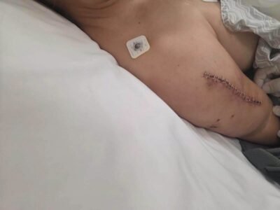 Nadia Beller recibe el alta médica tras el ataque y muestra sus heridas en redes 3 783617056 1699029804711509 1099717932490987237 n