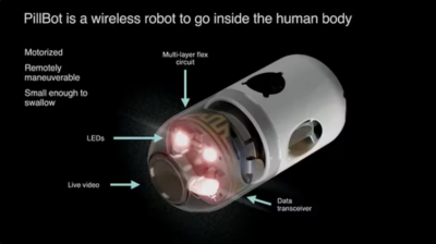 Screenshot 2024 07 04 at 09 30 47 Ingirio un mini robot inalambrico en vivo y transmitio en directo el interior de su cuerpo Infobae