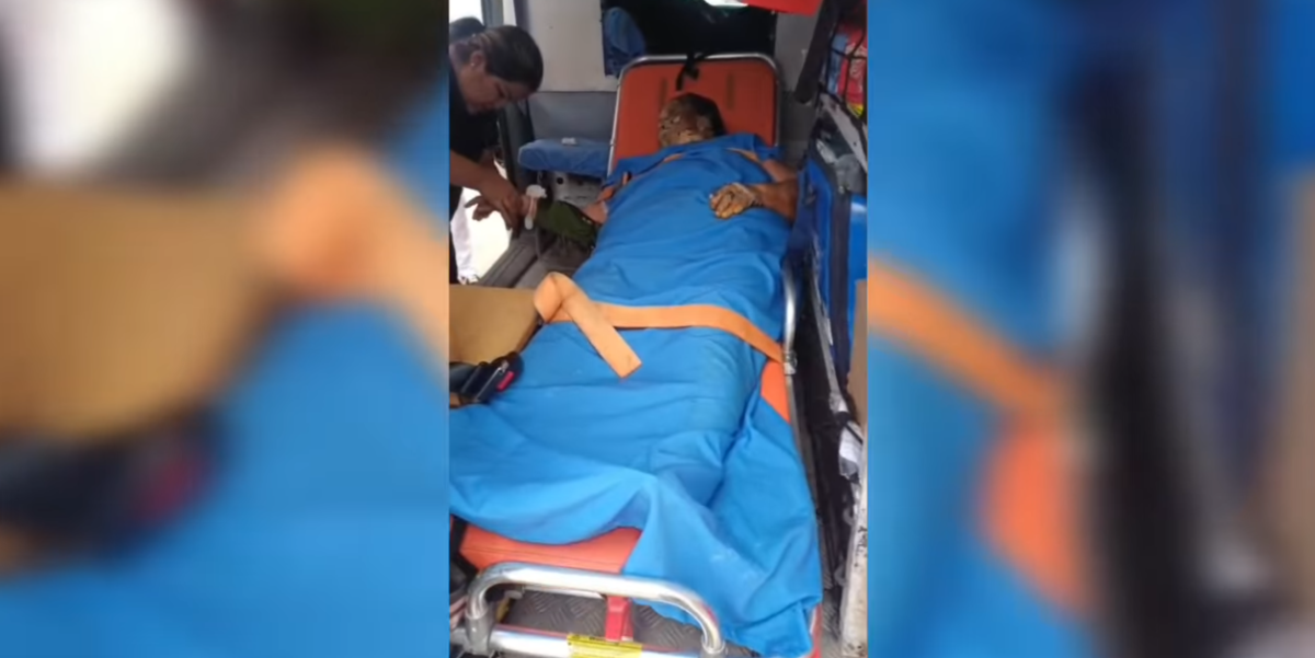 Santa Cruz: Mujer sufre quemaduras en el 90% de su cuerpo tras ...